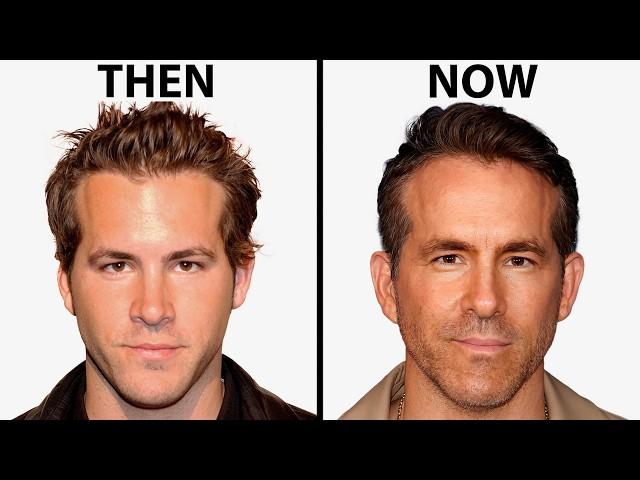 Ryan Reynolds NEW FACE | Plastic Surgery Analysis