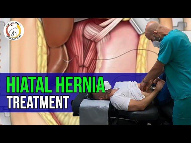 Hiatal Hernia Treatment |  Synergy Wellness Chiropractic & Physical Therapy PLLC