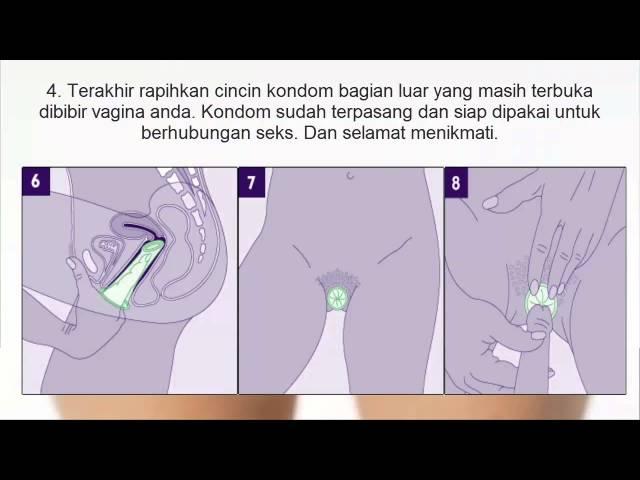 Cara memakai kondom wanita yang benar