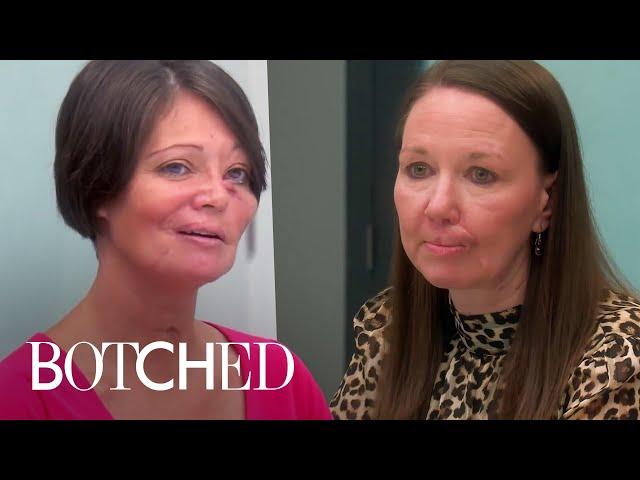 12 Minutes of UNBELIEVABLE Botched Transformations | E!