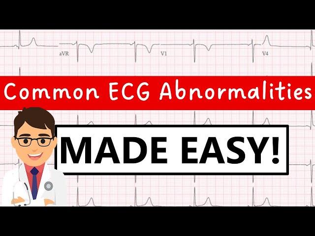 Common ECG abnormalities | MADE EASY!