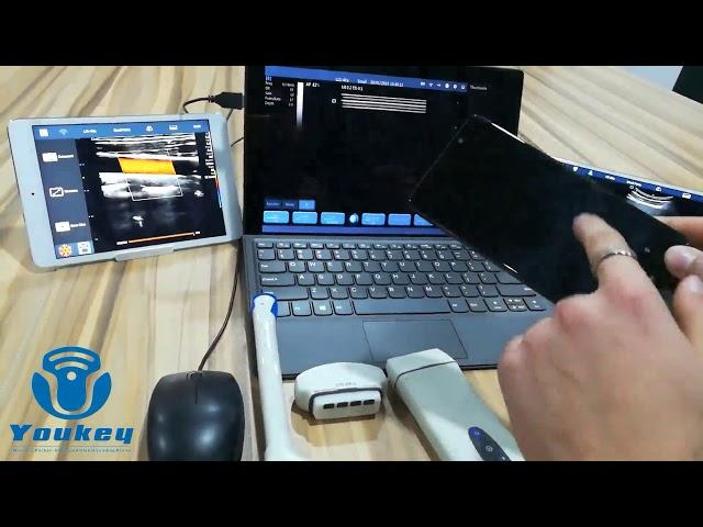 Youkey D8 Wireless Pocket Ultrasound system brief Introduction