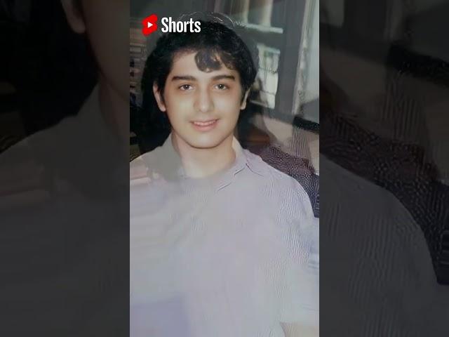 IAN VENERACION BEFORE AND AFTER #shorts #beforeandafter #showbiz