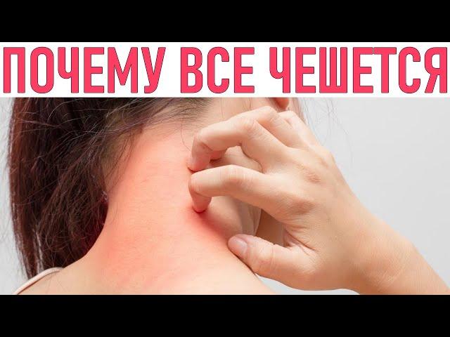 У МЕНЯ ВСЕ ЧЕШЕТСЯ ЧТО ДЕЛАТЬ | 10 неожиданных причин почему у вас всё чешется