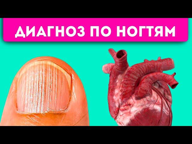 Маникюр не спасет! 8 проблем с ногтями, которые укажут на сердце, легкие, желудок и даже …