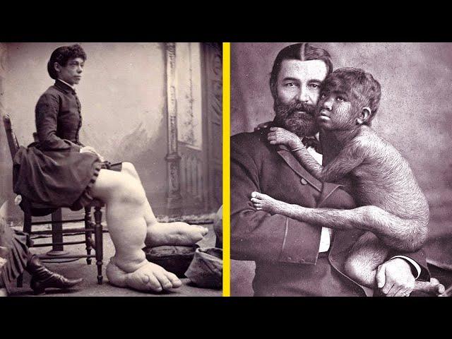 A Brief "Dark" History Of Freak Shows