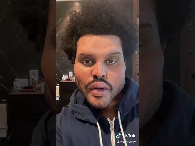 The Weeknd’s Plastic Surgery Before and After! (MUST WATCH) | tiktok edition ‼️ read description