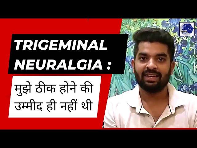 Trigeminal Neuralgia: Pain, Symptoms, Treatment.