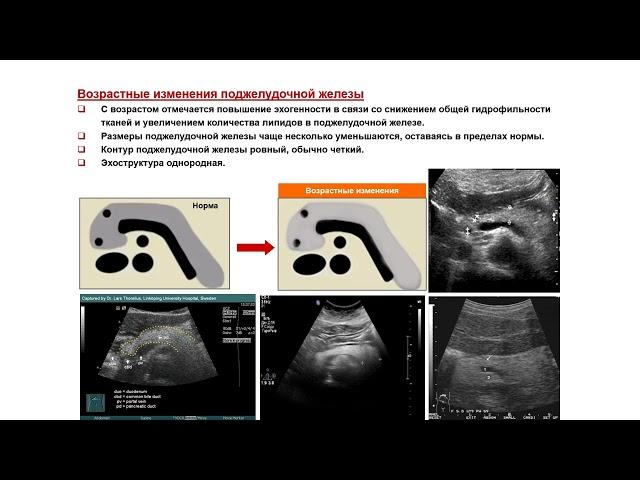 Ультразвуковая диагностика. Доктор Иогансен. Выпуск 45. Диффузные изменения поджелудочной железы.
