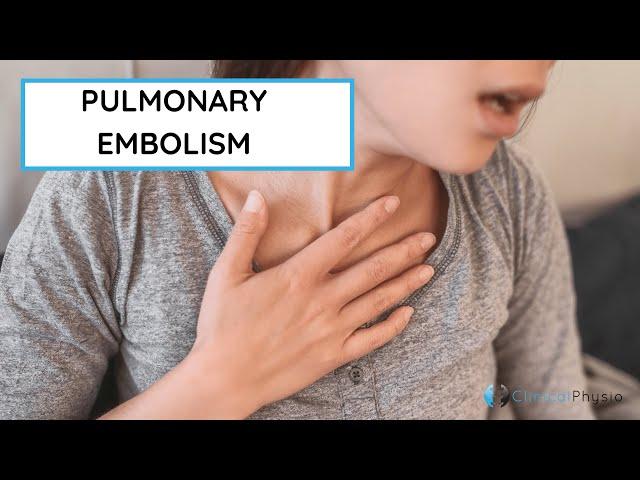 What is a Pulmonary Embolism?! | All you need to know