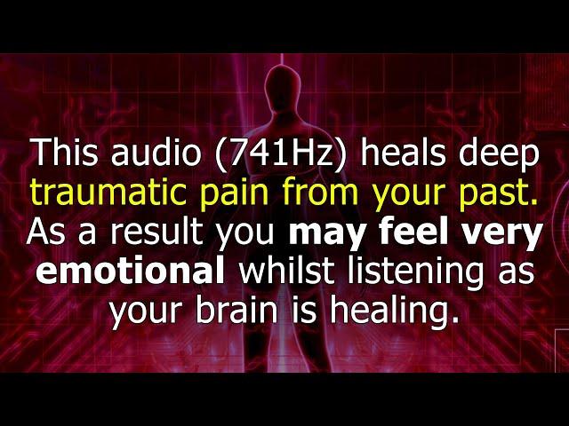 EMOTIONAL HEALING via Pineal Gland • 741Hz  EMDR Technique, Solfeggio Frequency