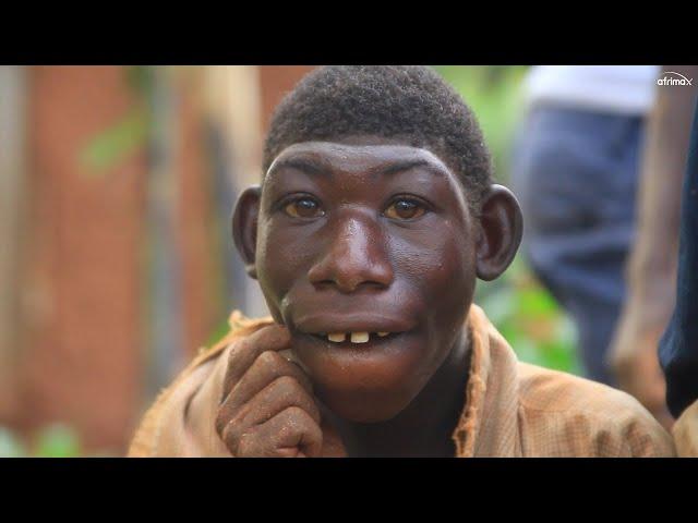 Bullies Call Him Monkey | BORN DIFFERENT