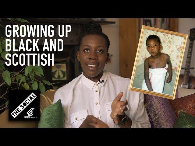 Growing Up Black In Scotland | Black History Month