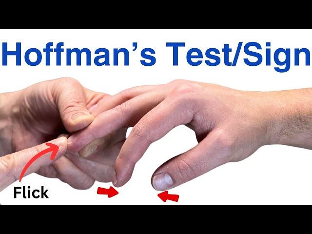 How to Perform a Hoffman's Test - Inverted Supinator Sign - Clonus - Hyperreflexia