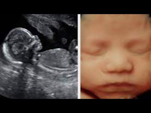 Watch the adorable 4D Ultrasound video of a baby girl's face at 27 weeks!