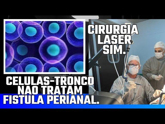 Células-Tronco não é técnica cirúrgica p/retirar fístula perianal a cirurgia c/laser sim: