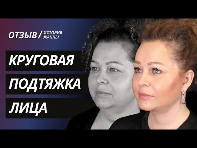 КРУГОВАЯ ПОДТЯЖКА ЛИЦА И ВЕРХНЯЯ БЛЕФАРОПЛАСТИКА | ПЛАСТИКА ВЕК | ФЕЙСЛИФТИНГ КИЕВ | ИСТОРИЯ ЖАННЫ