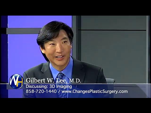 3D Imaging with San Diego, CA Plastic Surgeon, Gilbert Lee, M D