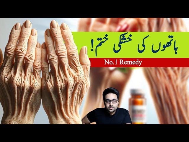 Dr. Zee:#1 Absolute Best Remedy for Dry and Wrinkled Hands उत्तम उपाय