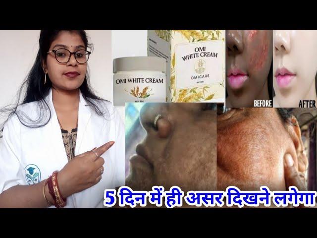 Omi white Skin Cream | Omi white cream honest review| Omi white cream benefit uses review in hindi |