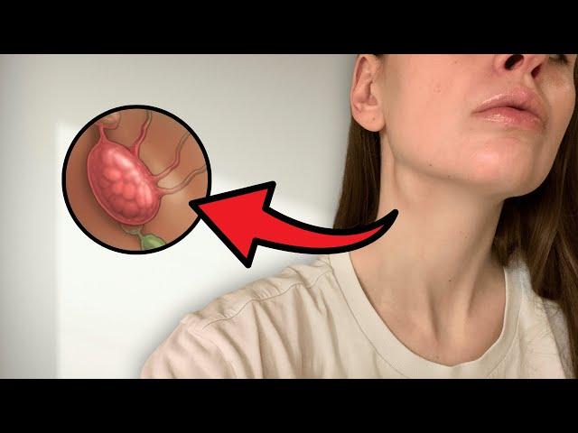 How I Found a Mass in My Neck | Surgery Update