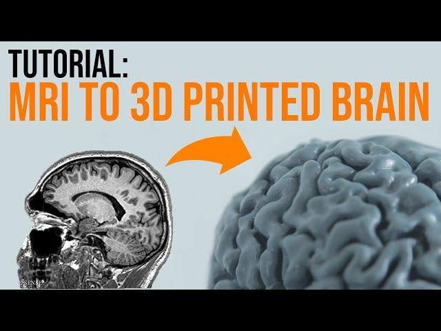 How To 3D Print Your Brain In A Few Simple Steps - TUTORIAL 2022