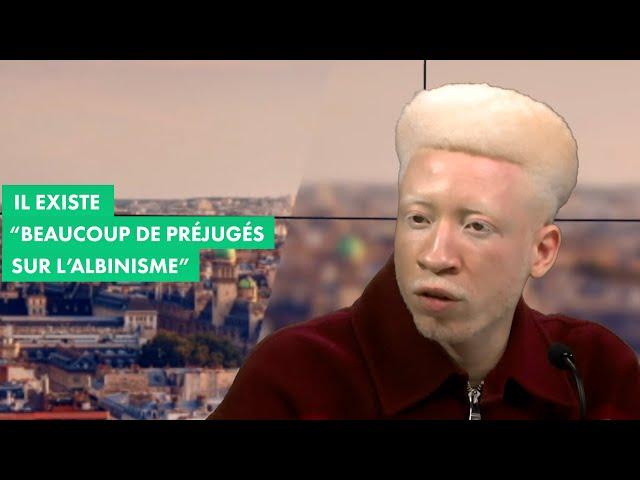 Il existe "beaucoup de préjugés sur l'albinisme"