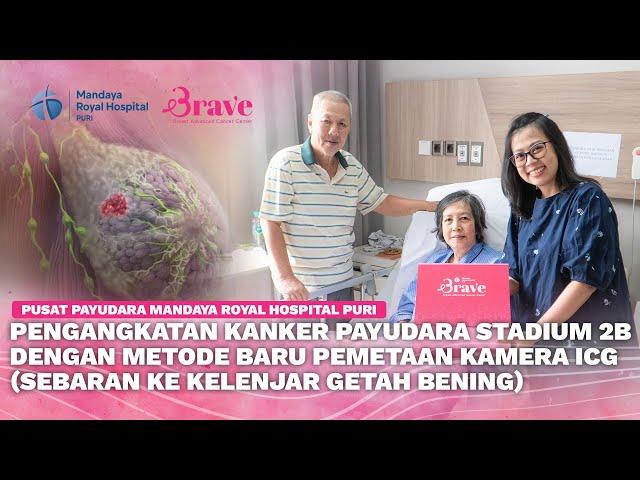 Testimoni Pasien Kanker Payudara Stadium 2 Lakukan Operasi Dengan Metode ICG Tumor Mapping