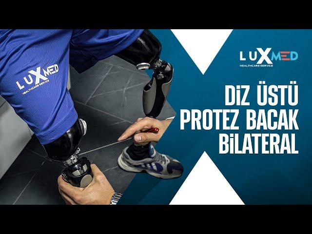 Bilateral Above Knee Prosthetic | Luxmed Protez