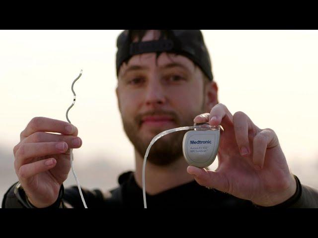 Harrison's story: Living with the Medtronic EV-ICD™ system