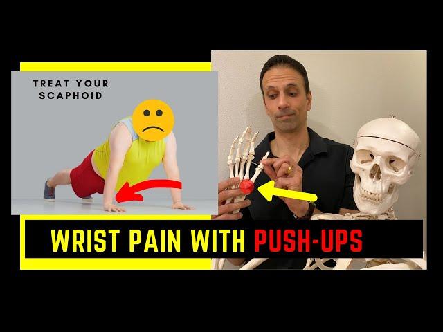 Can't do push-ups WRIST PAIN Treat the Scaphoid