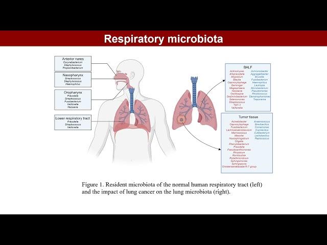 iMeta | Role of respiratory system microbiota in development of lung cancer and clinical application