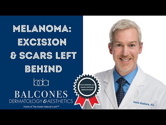 Melanoma Excision & Scars Left Behind | David Bushore, M.D. | Austin, TX | Ph: 512-459-4869