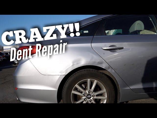 Hyundai Sonata | Extreme Auto Dent Repair | PDR | Dentless Touch | Paintless dent repair