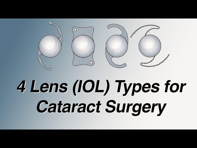 4 Main Lens (IOL) Types for Cataract Surgery: Pros and Cons (Basic Version)