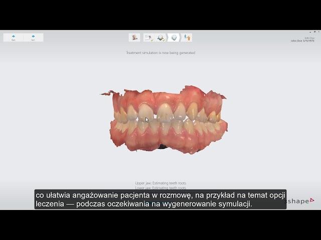 3Shape TRIOS Treatment Simulator Workflow PL