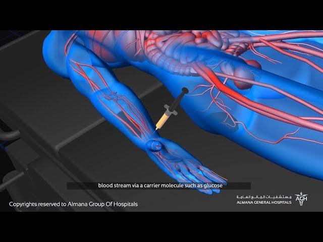 How PET SCAN works? | Nuclear Medicine