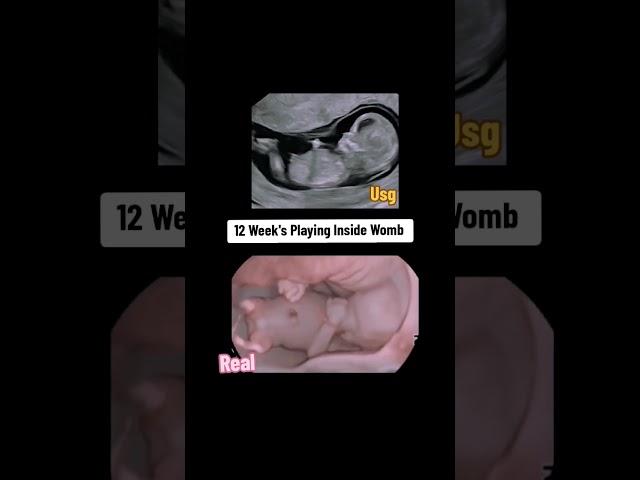 12 weeks baby playing inside Womb during ultrasound scan