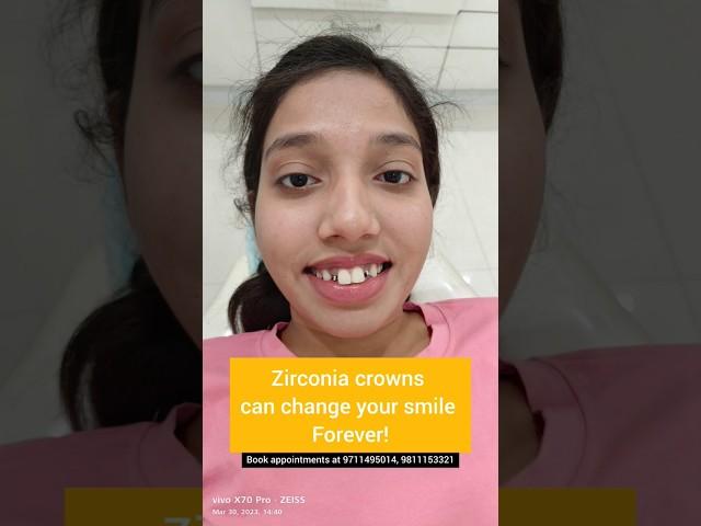 Transform your Smile with CAD CAM Zirconia crowns; Dr. Srishti Bhatia #dentist