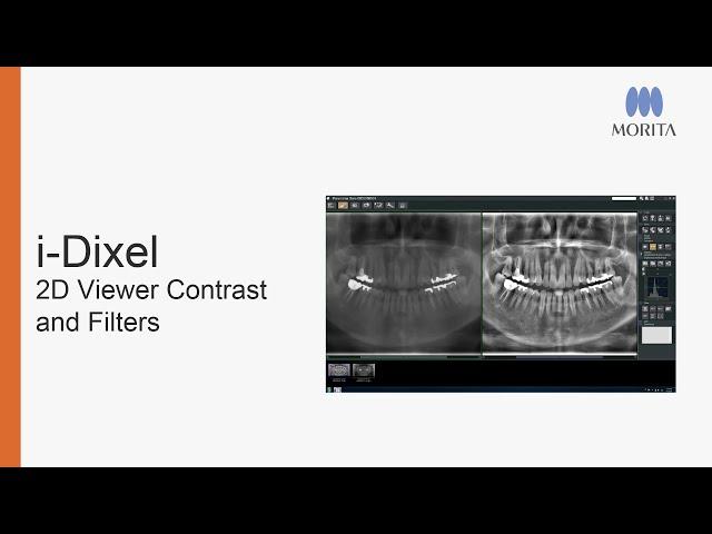 i-Dixel 2D Viewer - Adjusting Contrast and Filters