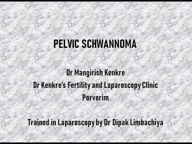 Pelvic Schwannoma - Laparoscopic Excision