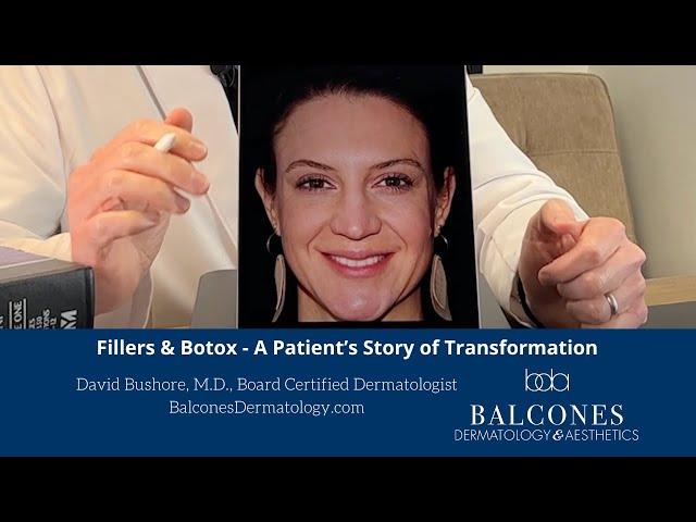 Fillers & Botox--A Patient Story of Transformation | David Bushore, MD, FAAD | Ph: 512-459-4869