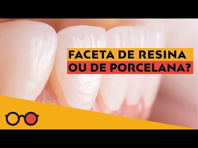 Qual a melhor Lente de contato dental? Facetas de resina ou porcelana? - Plantão de Dúvidas