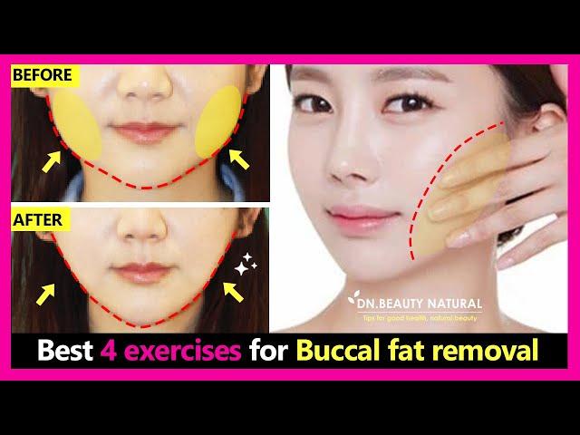 Best 4 exercises for Buccal Fat (Cheek fat) Removal naturally. How to lose Face fat without surgery.