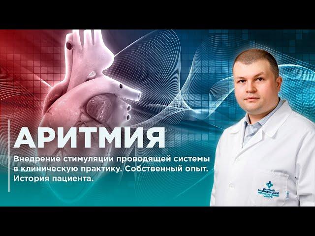 Аритмия. Стимуляция проводящей системы сердца. Истрия пациента ПКМЦ.