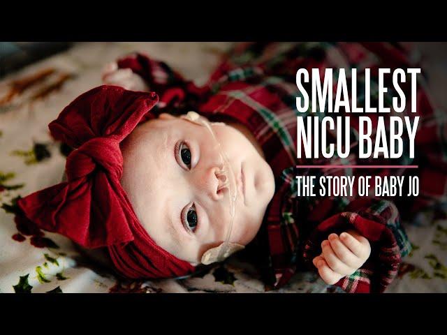 Smallest NICU Baby - The Story of Baby Jo