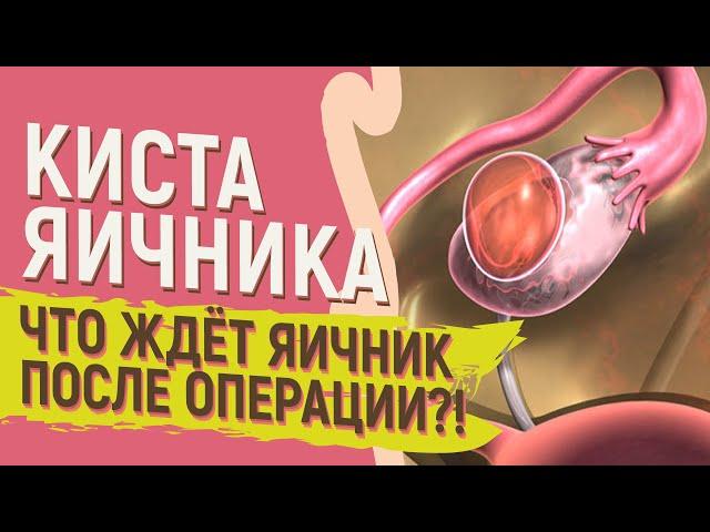 КИСТА ЯИЧНИКА  Что ждёт яичник ПОСЛЕ операции?!  Овариальный резерв яичников