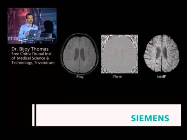 Dr. Bijoy Thomas part 1.flv