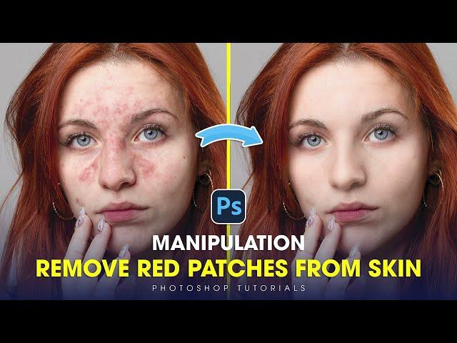 Photoshop Tutorials 2024 - How to remove red patches on skin most accurately