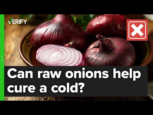 No, putting raw onions in your room or on your feet won’t cure your cold